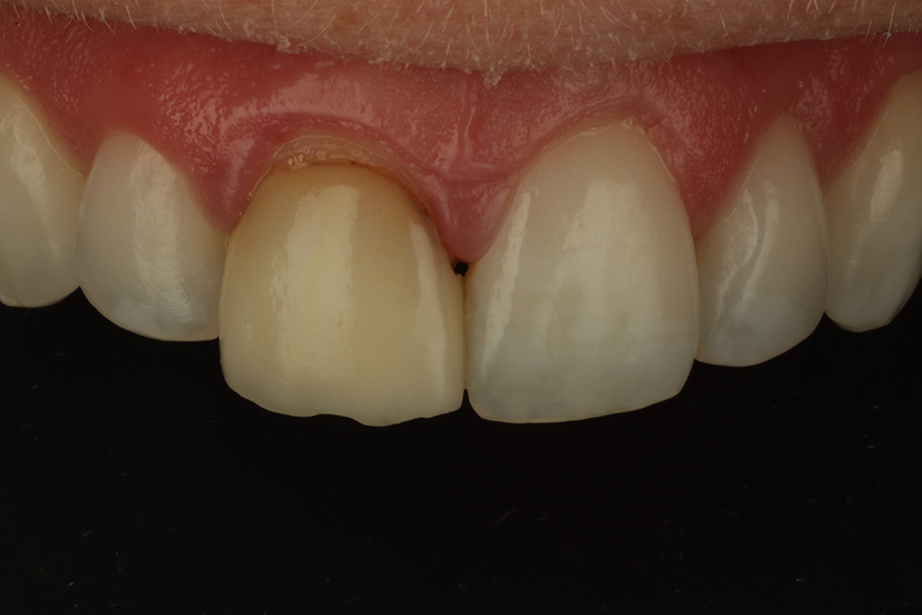 Before
